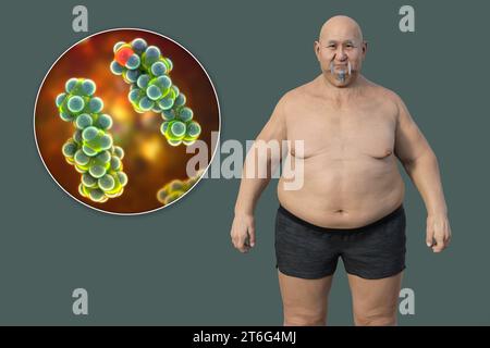 Un'illustrazione medica 3D con un uomo in sovrappeso con una vista ravvicinata di una molecola di colesterolo, evidenziando la connessione tra obesità e Foto Stock