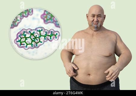 Un'illustrazione medica 3D con un uomo in sovrappeso con una vista ravvicinata di una molecola di colesterolo, evidenziando la connessione tra obesità e Foto Stock