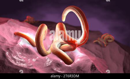 Nematode intrecciato singolo all'interno dell'intestino su sfondo nero - illustrazione 3d Foto Stock