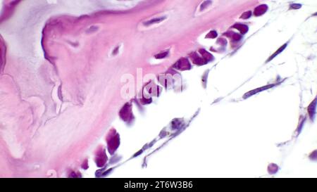 Micrografia leggera di ossificazione intramembranosa. Le trabecole ossee sono formate da osteoblasti che rivestono la loro superficie. Colorazione con ematossilina ed eosina Foto Stock