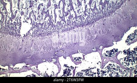 Sviluppo dell'osso al posto del modello cartilagine. La piastra di crescita è formata da cartilagine costituita da cellule della cartilagine in proliferazione. Foto Stock