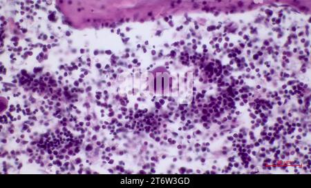 Struttura microscopica dell'istologia del midollo osseo rosso. La cellula più grande nel midollo osseo rosso è il megacariocita (situato al centro). Foto Stock