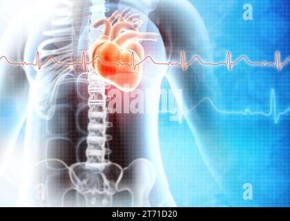 Attacco di cuore umano. Malattie cardiache. illustrazione 3d. Foto Stock