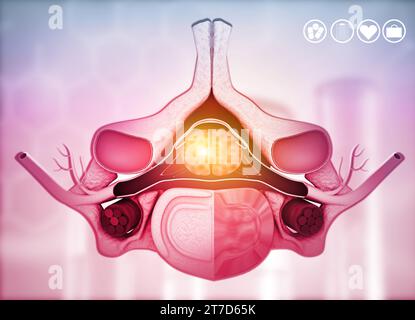 Anatomia del disco intervertebrale, colonna vertebrale umana. illustrazione 3d. Foto Stock