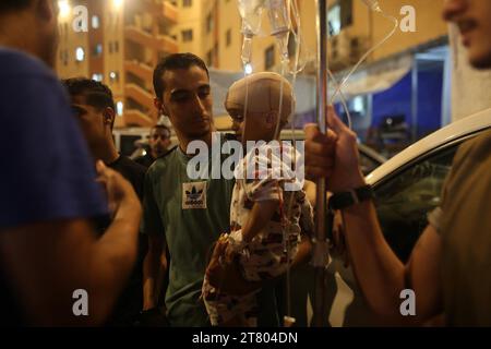 Un bambino palestinese ferito trasportato per essere curato a Khan Younis. Palestina. Foto Stock