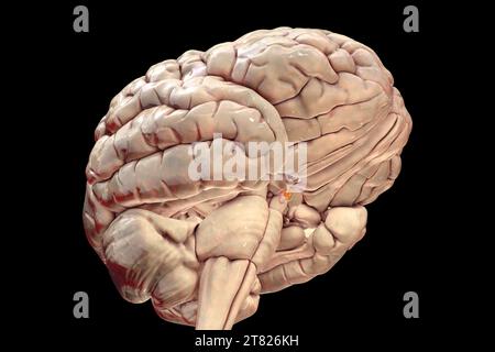 Tumore della ghiandola ipofisaria, illustrazione Foto Stock