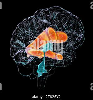 Ventricoli laterali ingranditi del cervello, illustrazione Foto Stock