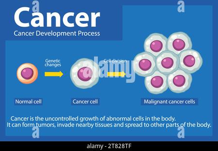 Comprendere lo sviluppo e la progressione delle cellule tumorali attraverso un'infografica informativa Illustrazione Vettoriale