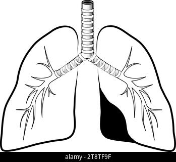 Icona della linea nera dei polmoni umani. Stile semplice. Pittogramma stilizzato per Web design o app mobili. Illustrazione vettoriale. simbolo linea piatta. Illustrazione Vettoriale