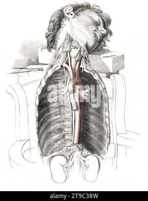 Menschliche Anatomie, Medizin, das Kreislaufsystem, Blutkreislauf: Sektion des Halses und des Brustkorbs, wobei die Arterien rot und die Venen blau dargestellt sind. Kolorierte Lithographie von J. Maclise, 1841/1844, Historisch, digital restaurierte Reproduktion von einer Vorlage aus dem 19. Jahrhundert / anatomia umana, medicina, sistema circolatorio, circolazione sanguigna: Sezione del collo e del torace, con le arterie in rosso e le vene in blu. Litografia colorata di J. Maclise, 1841/1844, storica riproduzione restaurata digitalmente da un originale del XIX secolo Foto Stock