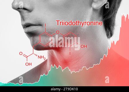 Collo maschile e grafico dell'ormone triiodotironina crescente prodotto dalla tiroide Foto Stock