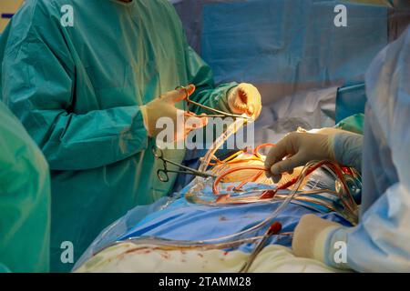 Durante la procedura chirurgica a cuore aperto al paziente in sala operatoria Foto Stock