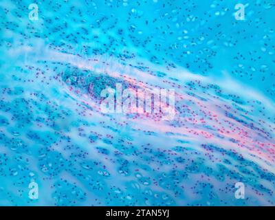 Cartilagine ialina umana, micrografia leggera Foto Stock