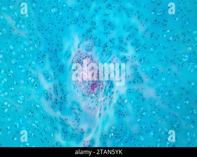 Cartilagine ialina umana, micrografia leggera. Foto Stock