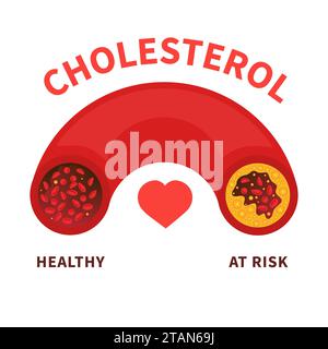 Livelli di colesterolo, illustrazione concettuale Foto Stock
