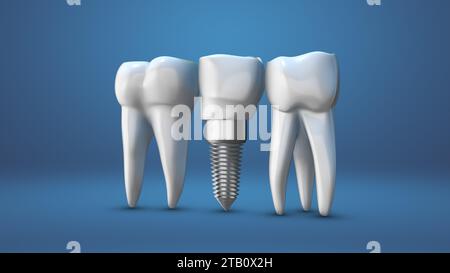 Animazione dei denti e delle protesi umane Foto Stock