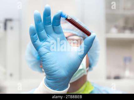 Il medico tiene una provetta con un sangue di analisi, concentrarsi su una mano, il viso sfocato. Ricerca del sangue del paziente Foto Stock