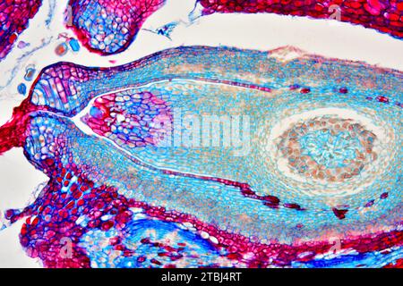 Cono femmina di pino (Pinus sp.) con ovuli. Microscopio ottico X100. Foto Stock