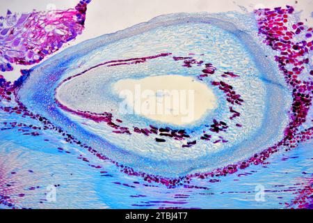 Cono femmina di pino (Pinus sp.) che mostra l'ovulo. Microscopio ottico X40. Foto Stock