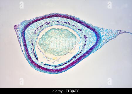 Cono femmina di pino (Pinus sp.) mostra embrione ed endosperma. Microscopio ottico X40. Foto Stock