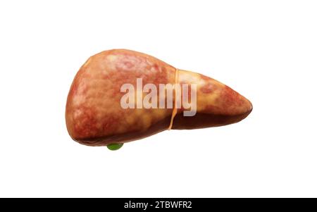 Organo epatico con stato fegato grasso, rendering 3D. Illustrazione 3D. Foto Stock