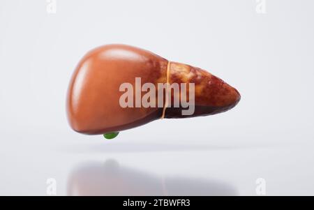 Organo epatico con stato fegato grasso, rendering 3D. Illustrazione 3D. Foto Stock