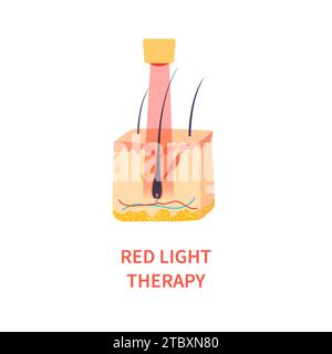 Terapia a luce rossa, illustrazione concettuale Foto Stock