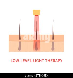 Terapia della luce, illustrazione concettuale Foto Stock