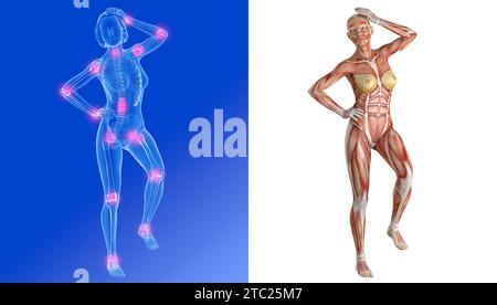 illustrazione 3d di due immagini di donne con dolore articolare. Mostra l'anatomia dello scheletro interno trasparente e dei muscoli. Foto Stock