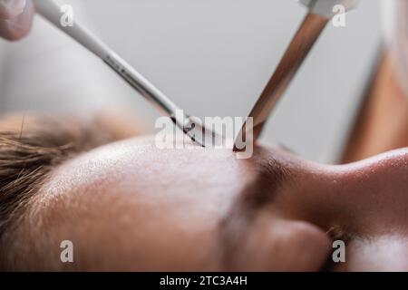 Pulizia a ultrasuoni della pelle. Foto ravvicinata, macro. Foto Stock