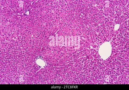Fegato umano sano con epatociti normali. Microscopio ottico. Ingrandimento X100. Foto Stock
