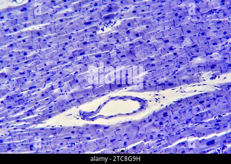 Muscolo cardiaco che mostra miociti. Microscopio leggero X300 con larghezza di 10 cm. Foto Stock