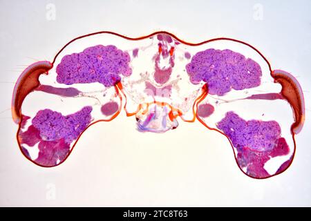 Testa di insetto, sezione trasversale che mostra cervello, occhi composti, nervi ottici e cuticola. Microscopio leggero X50 con larghezza di 10 cm. Foto Stock