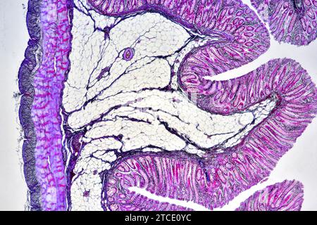 Colon umano che mostra epitelio, mucosa, sottomucosa, strato muscolare, tessuto adiposo, sierosa, ghiandole intestinali, villi e vasi. Microscopio ottico X4 Foto Stock