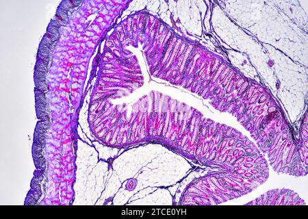 Colon umano che mostra epitelio, mucosa, sottomucosa, strato muscolare, tessuto adiposo, sierosa, ghiandole intestinali, villi e vasi. Microscopio ottico X4 Foto Stock