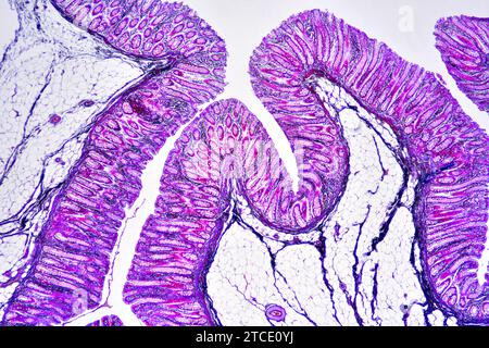 Colon umano che mostra epitelio, mucosa, sottomucosa, tessuto adiposo, ghiandole intestinali, villi e vasi. Microscopio ottico X40. Foto Stock