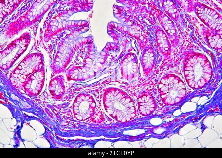Colon umano che mostra epitelio, mucosa, sottomucosa, tessuto adiposo, ghiandole intestinali e villi. Microscopio ottico X40. Foto Stock