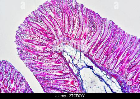 Colon umano che mostra epitelio, mucosa, sottomucosa, tessuto adiposo, ghiandole intestinali e villi. Microscopio ottico X100. Foto Stock