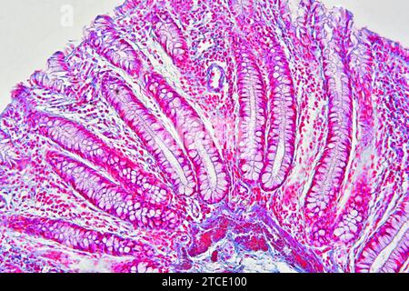 Colon umano che mostra epitelio, mucosa, sottomucosa, ghiandole intestinali e villi. Microscopio ottico X100. Foto Stock