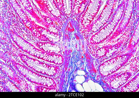 Colon umano che mostra epitelio, mucosa, sottomucosa, tessuto adiposo, ghiandole intestinali e villi. Microscopio ottico X100. Foto Stock