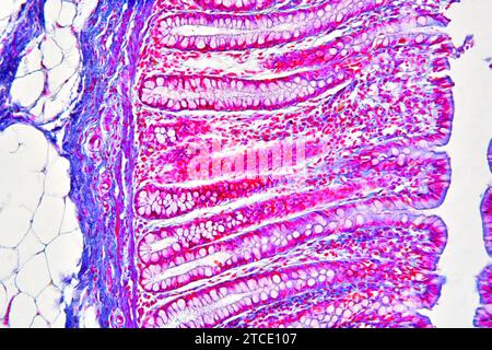 Colon umano che mostra epitelio, mucosa, sottomucosa, tessuto adiposo, ghiandole intestinali e villi. Microscopio ottico X100. Foto Stock