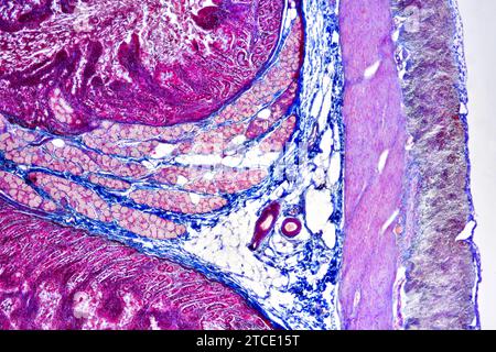 Duodeno umano (intestino tenue) che mostra mucosa villosa, sottomucosa, strato muscolare, sierosa, vaso, ghiandole Brunner e ghiandole duodenali. micros ottici Foto Stock