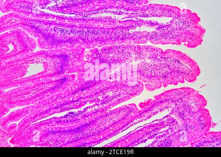 Sezione trasversale dell'intestino tenue che mostra mucosa, sottomucosa e ghiandole Brunner. Microscopio ottico X100. Foto Stock