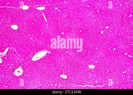 Fegato umano normale con epatociti e vasi sanguigni. Microscopio ottico X40. Foto Stock