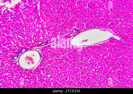 Fegato umano sano o normale con epatociti e vasi sanguigni. Microscopio ottico X100. Foto Stock