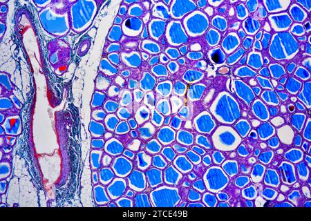 Ghiandola tiroidea umana che mostra follicoli, cellule endoteliali e cellule follicolari. Microscopio ottico X40. Foto Stock