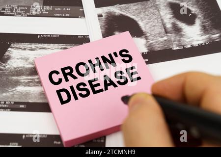 Concetto medico. Sulle immagini ecografiche ci sono adesivi che dicono - malattia di Crohns Foto Stock