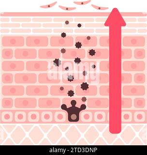 Illustrazione vettoriale della normale rotazione cutanea Illustrazione Vettoriale