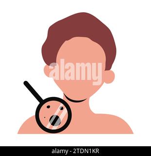 Diagnosi di melanoma esame dermatologico icona illustrazione vettoriale Illustrazione Vettoriale