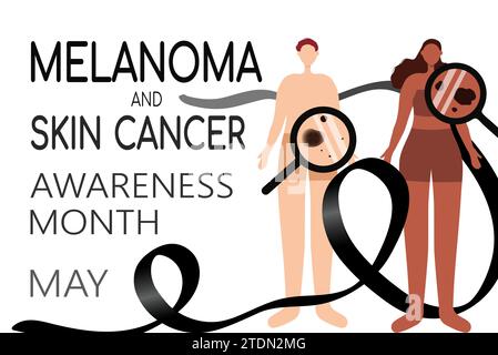 Illustrazione vettoriale del mese di sensibilizzazione sul melanoma e sul cancro cutaneo Illustrazione Vettoriale